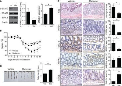 Metformin-Inducible Small Heterodimer Partner Interacting Leucine Zipper Protein Ameliorates Intestinal Inflammation